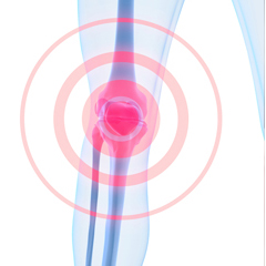 second opinion for knee surgery