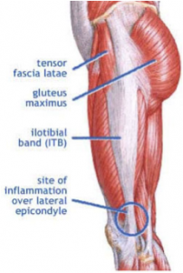 At Home IT Band Syndrome Physical Therapy