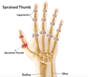 thumb pain typing thumb pain typing