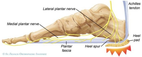 heel fat pad taping