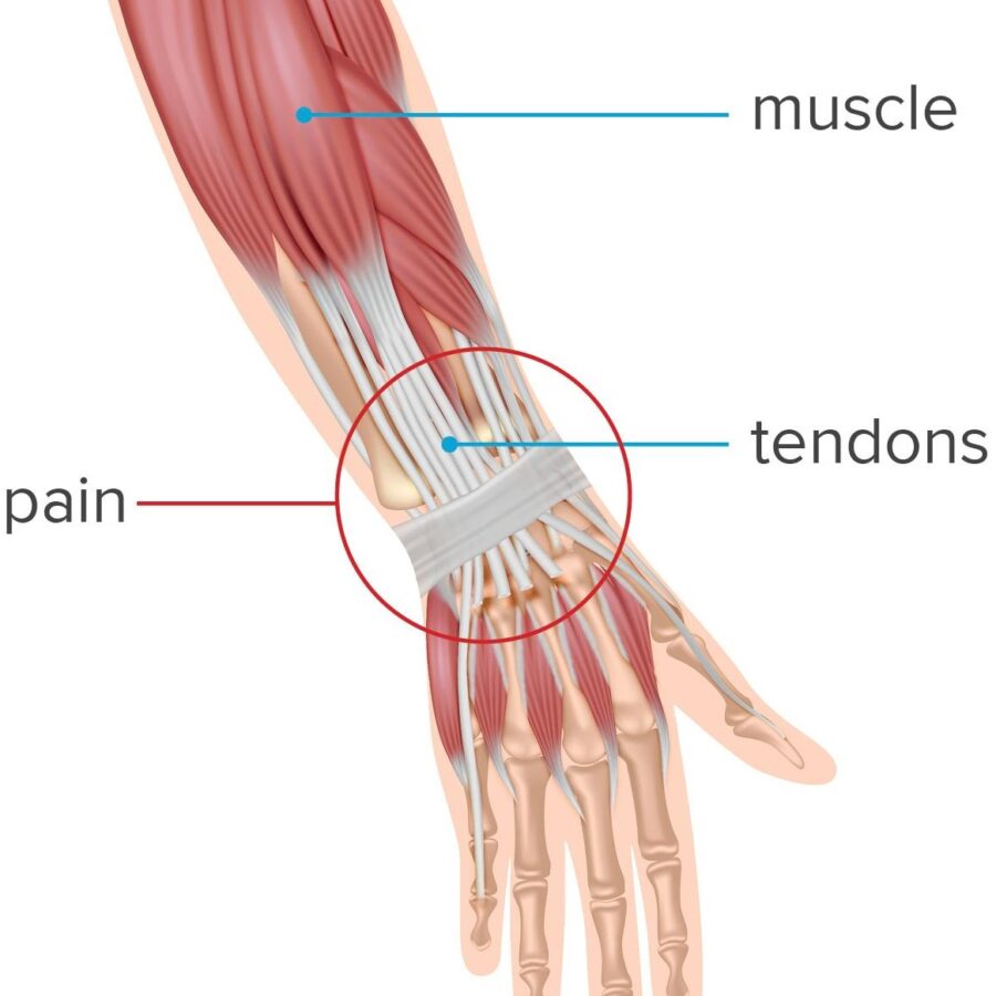 Sports Injuries A to Z Symptoms, Treatment and Recovery SportsMD