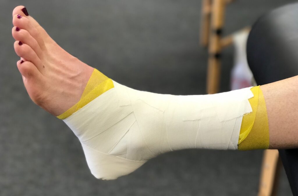 Ankle Taping vs ankle bracing