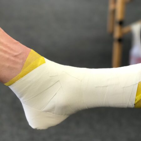 Ankle Taping vs ankle bracing