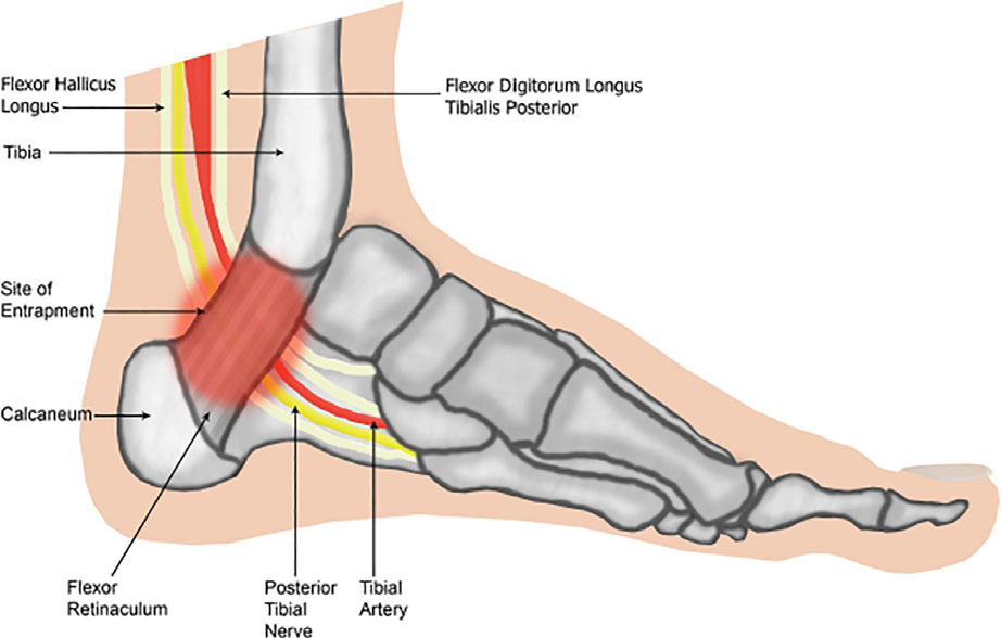 Calf Pain or Strain Stretches & Exercises - Ask Doctor Jo 